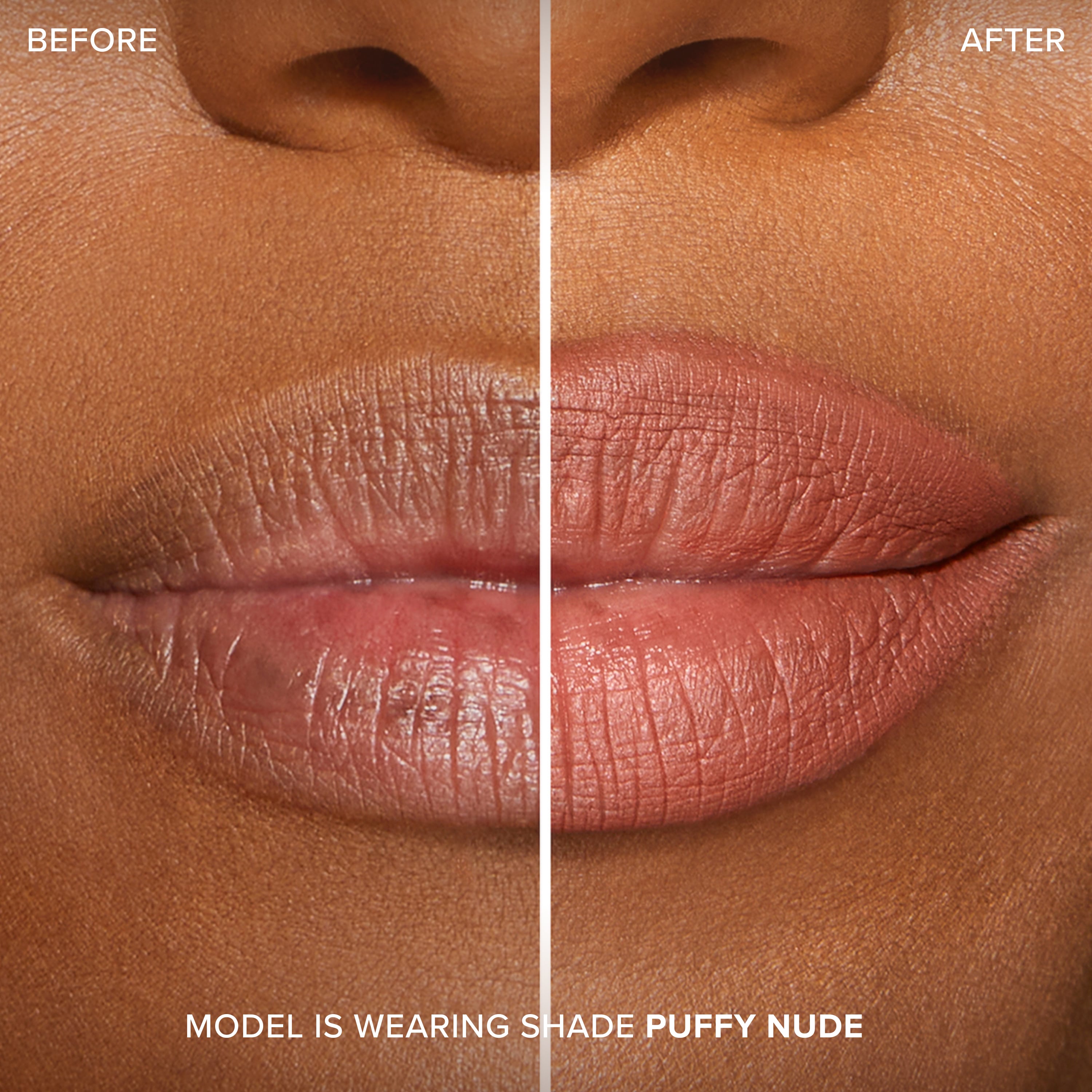 Lip Injection Extreme Lip Shaper